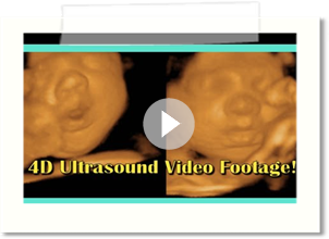 4D Ultrasound Video Footage!