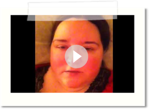 ECT Treatment #7 - 2-26-2014