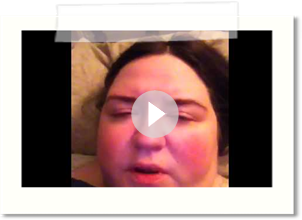ECT Treatment #11 - 3-7-14