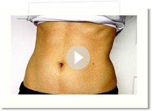 Lose Weight Fast for Prom!